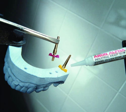 Aron Alpha Industrial Krazy Glue being used being used in attaching dental pins for dentures